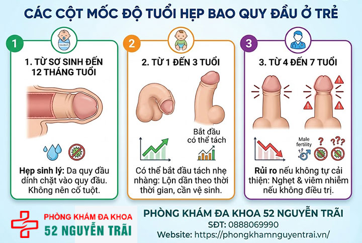 Hẹp bao quy đầu ở trẻ: Dấu hiệu nhận biết và cách xử lý 2 Ảnh minh hoạ Các cột mốc độ tuổi hẹp bao quy đầu ở trẻ