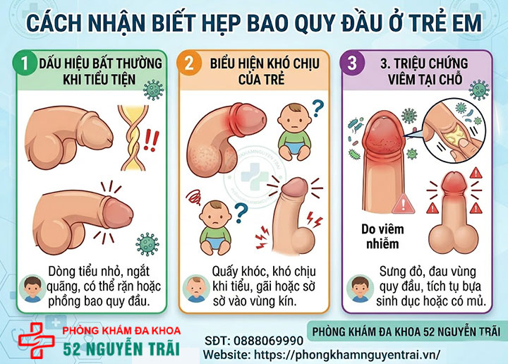 Hẹp bao quy đầu ở trẻ: Dấu hiệu nhận biết và cách xử lý 3 Ảnh minh hoạ Cách nhận biết hẹp bao quy đầu ở trẻ em