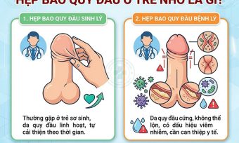 Hẹp bao quy đầu ở trẻ: Dấu hiệu nhận biết và cách xử lý