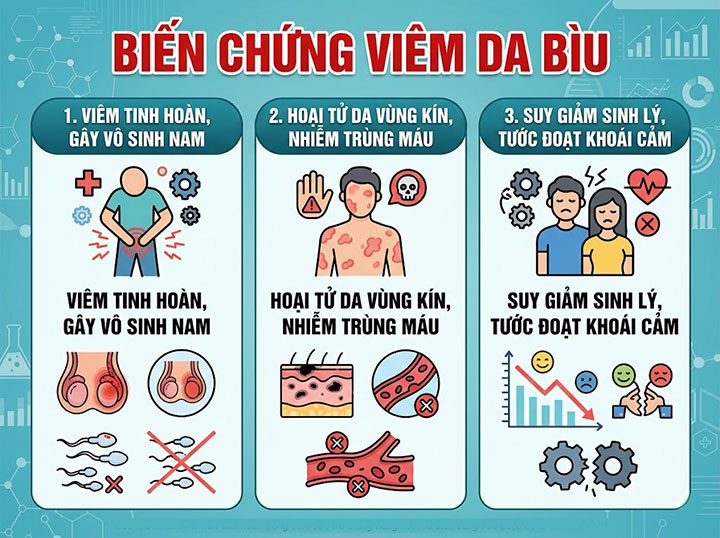 Viêm da bìu tinh hoàn: đừng chủ quan với cơn ngứa rát – xử lý ngay tránh biến chứng hoại tử, vô sinh! 5 Biến chứng Viêm da bìu
