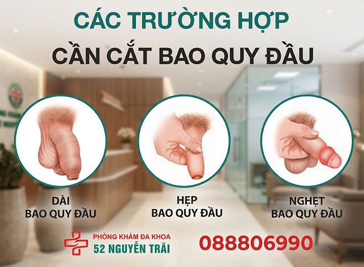 Đối tượng nam giới cần thực hiện cắt bao quy đầu ngay