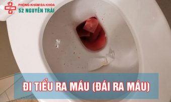 Hiện tượng tiểu ra máu ở nữ là bệnh gì? Khám nhanh & bảo mật tại hà nội