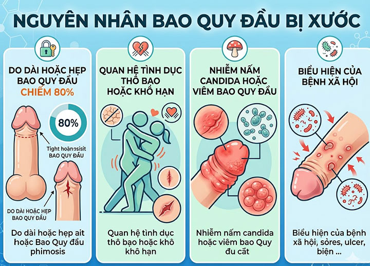 Bao quy đầu bị xước, nứt da – hiểm họa nhiễm trùng "cậu nhỏ" chớ lơ là! 2 Nguyên nhân bao quy đầu bị xước