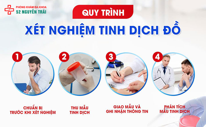 Tinh trùng vón cục như thạch: có nguy hiểm không? Điều trị cách nào nhanh nhất? 8 Quy trình xét nghiệm tinh dịch đồ