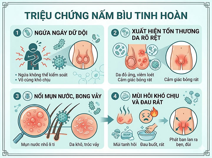 Nấm bìu tinh hoàn: ngứa ngáy điên cuồng – đừng để "oanh tạc" bản lĩnh phái mạnh! 2 Triệu chứng Nấm bìu tinh hoàn