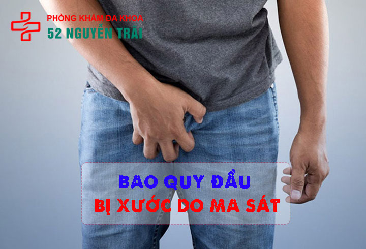 Bao quy đầu bị xước do ma sát