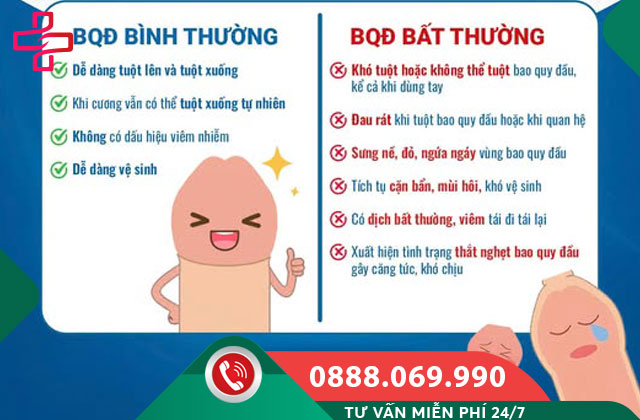 Bất thường bao quy đầu