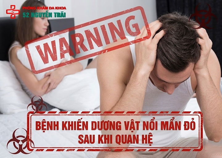 bệnh khiến dương vật nổi mẩn đỏ sau khi quan hệ