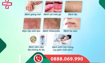 Mức độ nguy hiểm của các bệnh xã hội với nữ giới