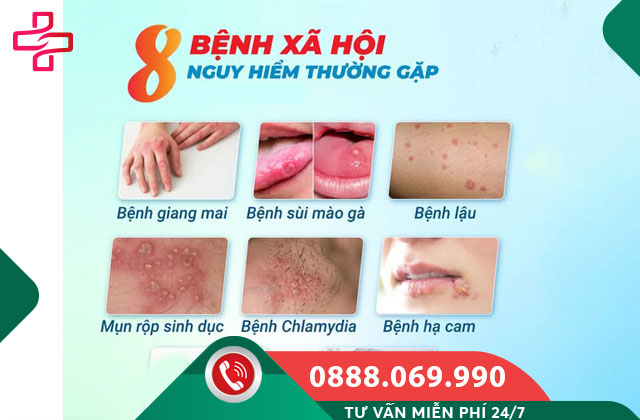Bệnh xã hội (lây qua đường tình dục)