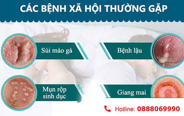 Bệnh xã hội ở nữ