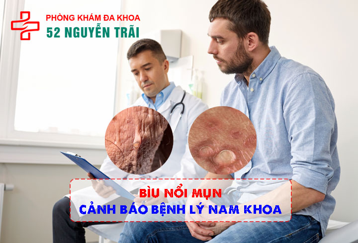 Bìu nổi mụn: Cảnh báo bệnh lý nam khoa