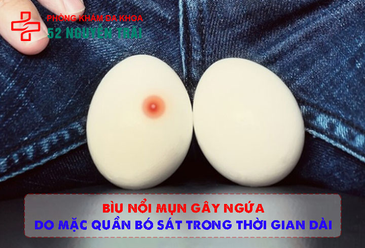 Bìu nổi mụn gây ngứa
