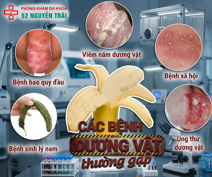 Bệnh dương vật thường gặp: Nguyên nhân và cách phòng tránh