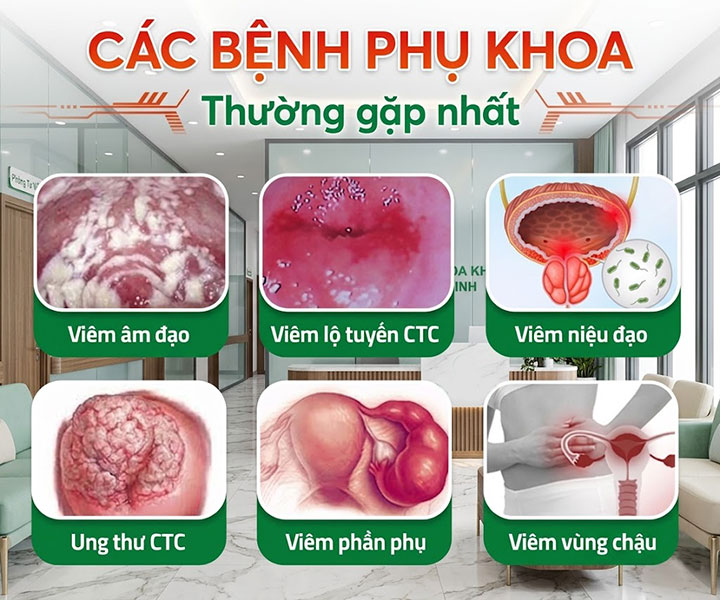 các bệnh phụ khoa thường gặp