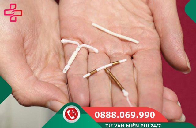 Các loại que tránh thai được ưa dùng hiện nay