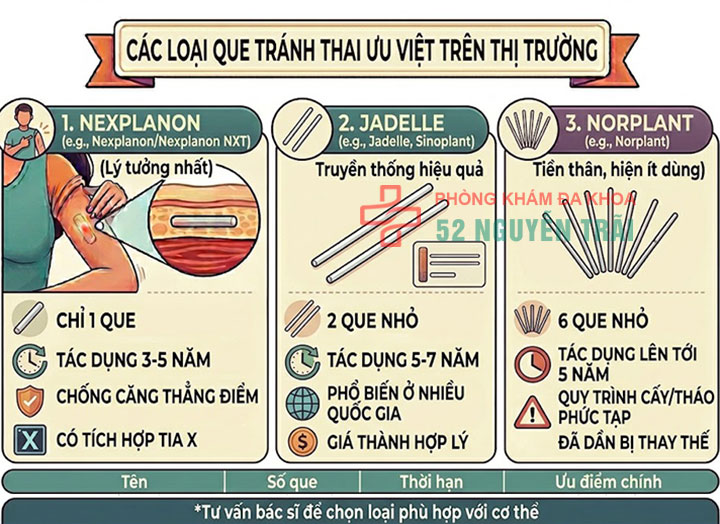 Cấy que tránh thai: Giải pháp ngừa thai hiện đại, an toàn 4 Các loại que tránh thai được ưa dùng trên thị trường