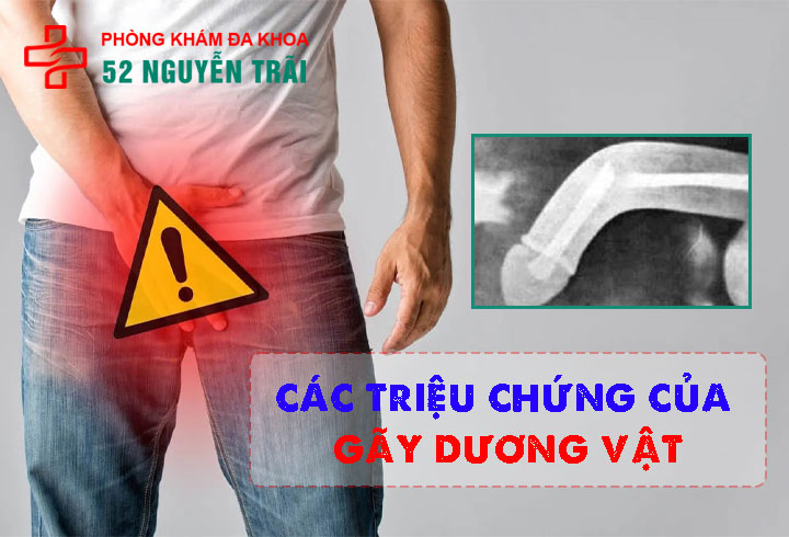 Cách xử lý khi bị gãy dương vật kịp thời