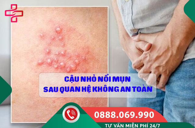Cậu nhỏ nổi mụn sau quan hệ không an toàn