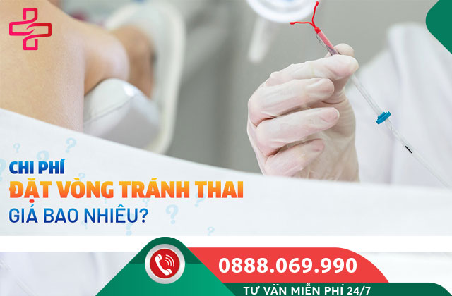 Chi phí đặt vòng tránh thai tại Hà Nội