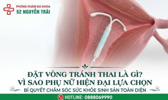 Đặt vòng tránh thai: Phương pháp ngừa thai an toàn, hiệu quả