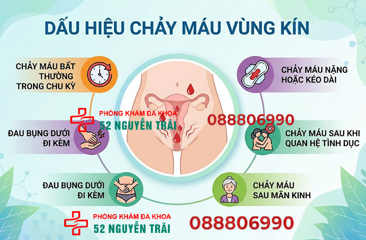 Chảy máu vùng kín là dấu hiệu gì? Nguyên nhân và cách chữa 4 Dấu hiệu chảy máu vùng kín
