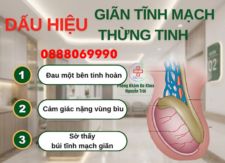 dấu hiệu giãn tĩnh mạch thừng tinh