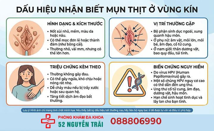 Mụn thịt ở vùng kín 7 Dấu hiệu nhận biết mụn thịt ở vùng kín
