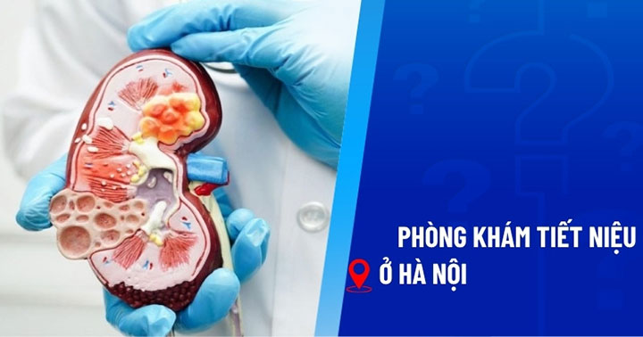 Địa chỉ khám tiết niệu uy tín tại Hà Nội