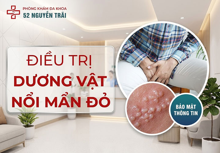 Điều trị dương vật nổi mẩn đỏ