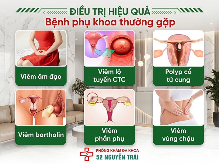 điều trị hiệu quả bệnh phụ khoa