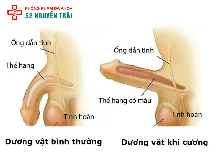 Dương vật cương cứng