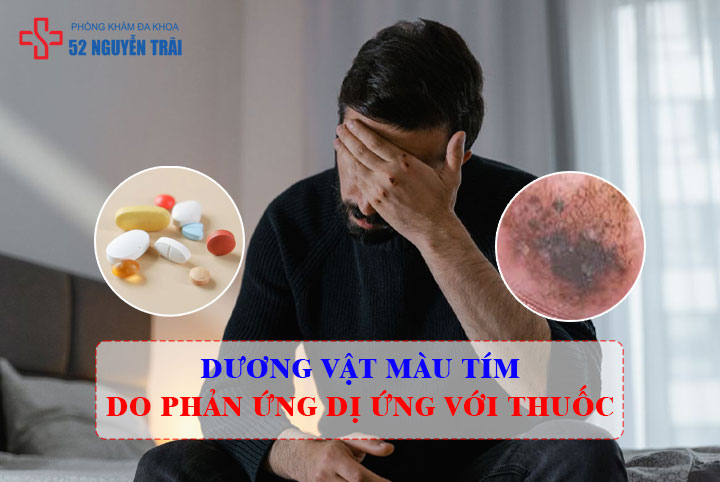 dương vật màu tím do phản ứng dị ứng với một số loại thuốc