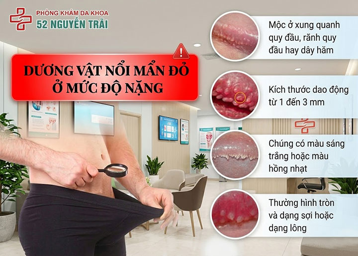 dương vật nổi mẩn đỏ ở Mức độ nặng