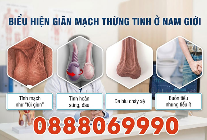 giãn tĩnh mạch thừng tinh