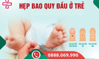 Hẹp bao quy đầu ở trẻ em