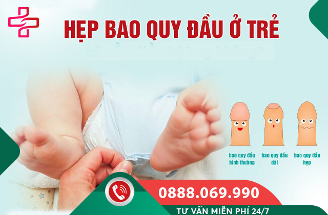 Hẹp bao quy đầu ở trẻ em