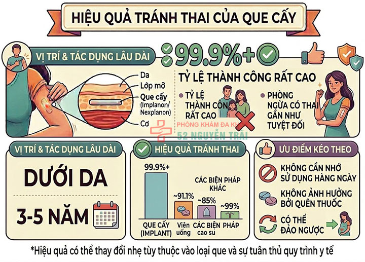 Cấy que tránh thai: Giải pháp ngừa thai hiện đại, an toàn 3 Hiệu quả tránh thai của que cấy