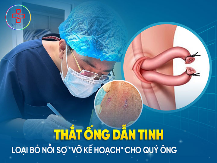 Thắt ống dẫn tinh là gì? Khi nào nên lựa chọn? Ưu nhược điểm