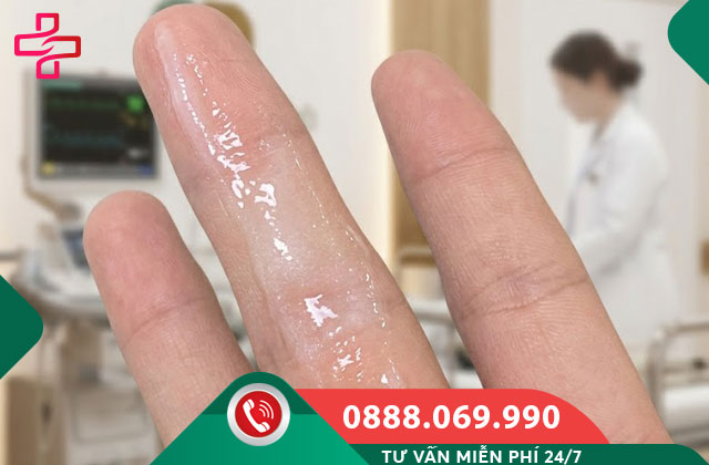 Khí Hư Bất Thường: Ra Nhiều Liên Tục