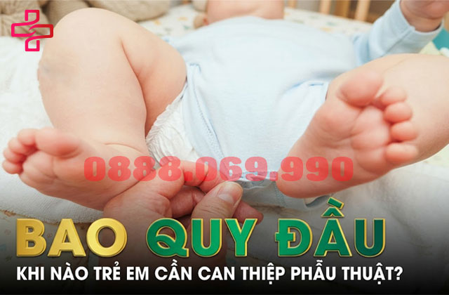 Khi nào cần cắt bao quy đầu ở trẻ nhỏ?