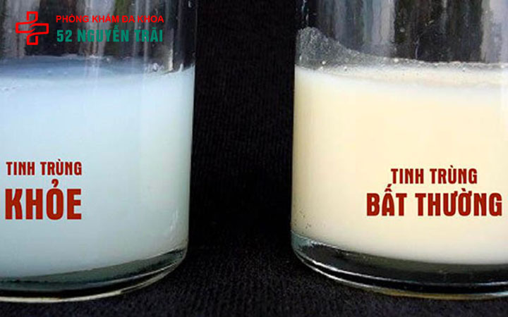 Kiểm tra tinh trùng ở đâu nhanh - chính xác? Chi phí bao nhiêu tiền? 2 kiểm tra tinh trùng