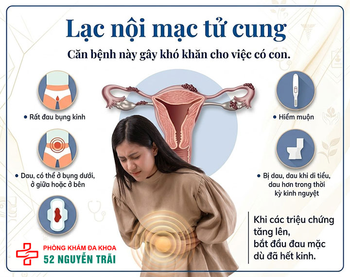 Đau bụng dưới ở phụ nữ 5 Lạc nội mạc tử cung