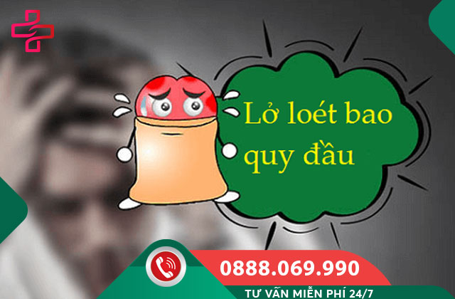 Loét bao quy đầu là gì?