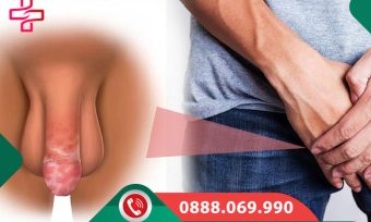 Mẩn ngứa ở bao quy đầu