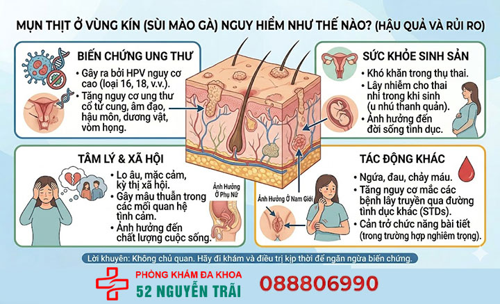 Mụn thịt ở vùng kín 11 Mụn thịt ở vùng kín nguy hiểm như thế nào