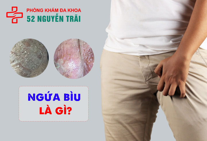 Ngứa bìu, ngứa rát da tinh hoàn là bệnh gì? Khám bảo mật tại hà nội