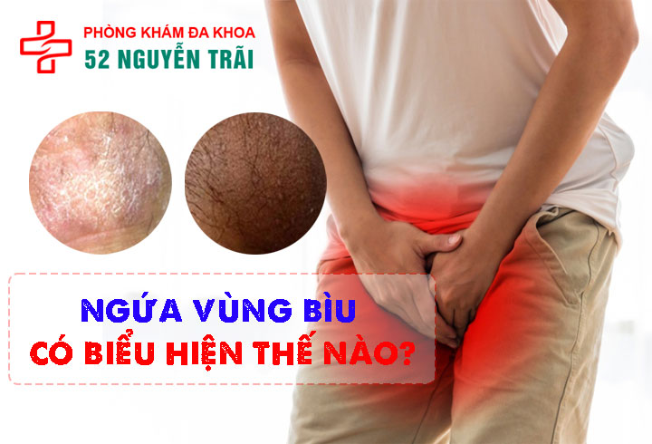 Ngứa vùng bìu có biểu hiện thế nào?