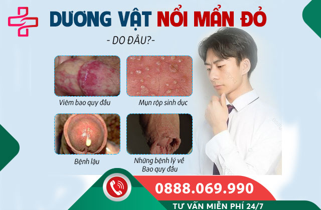Nguyên nhân gây mẩn ngứa ở bao quy đầu