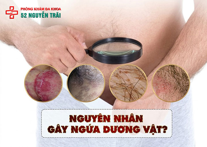Ngứa dương vật, ngứa rát bao quy đầu là bệnh gì? Khám kín đáo tại hà nội